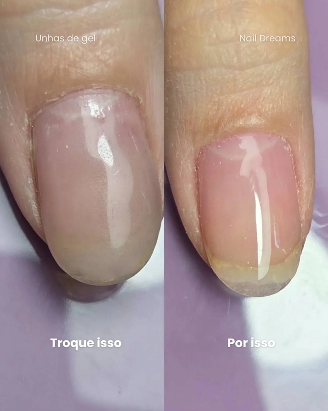 Comparativo de unha de gel antes e depois