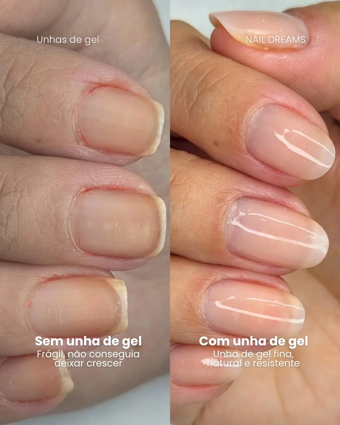 Comparativo de unha frágil e resultado com unha de gel